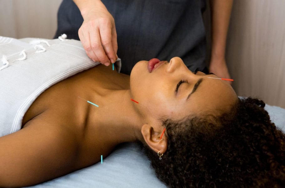 A woman receiving an acupuncture facial.