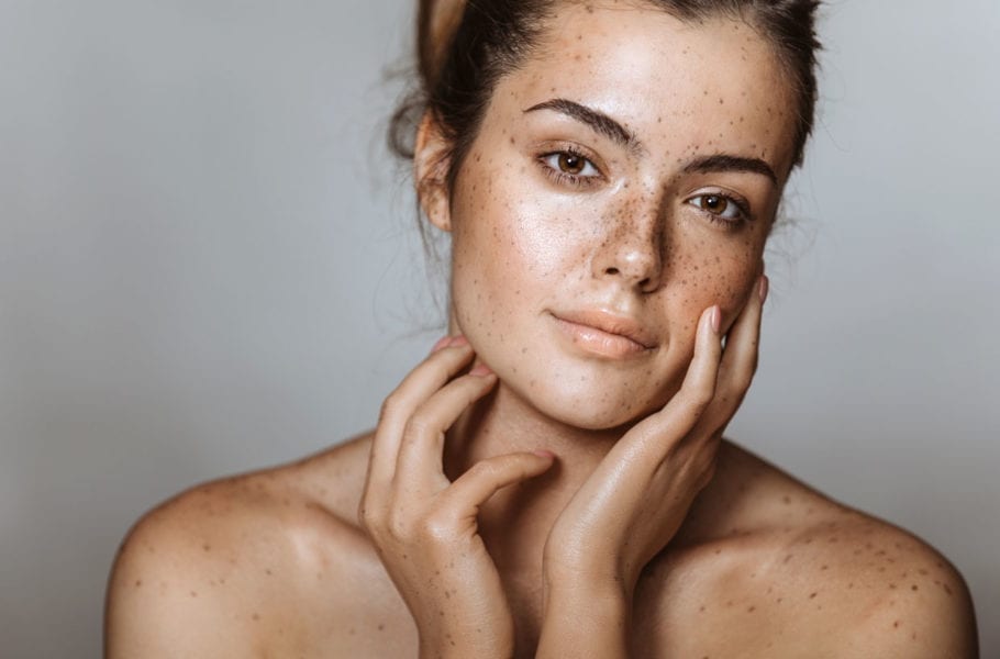 A woman with freckles.