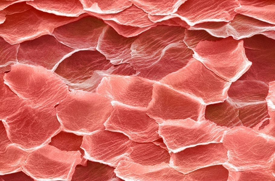 Coloured electron micrograph (SEM) of epidermal skin cells.