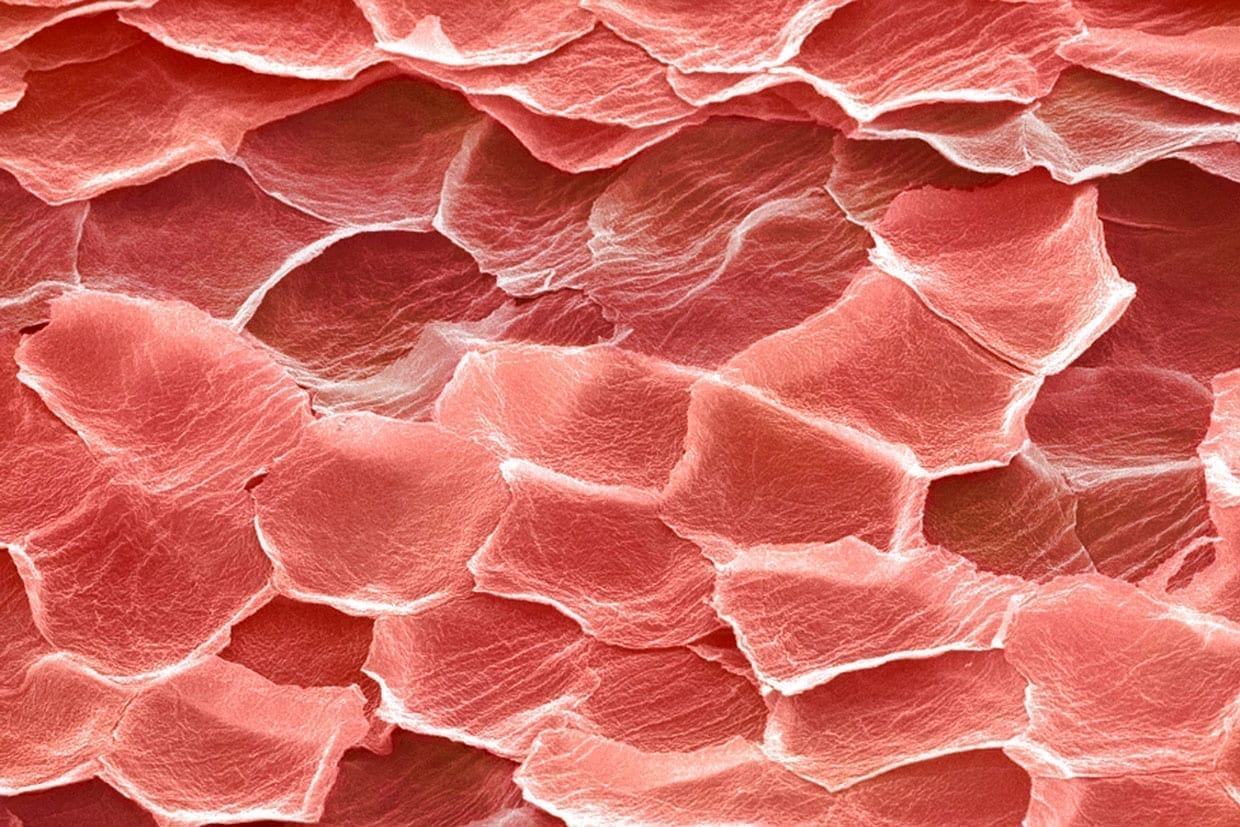 Coloured electron micrograph (SEM) of epidermal skin cells.
