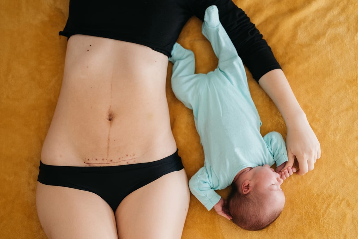 A woman's torso with a c-section scar lies next to her baby.