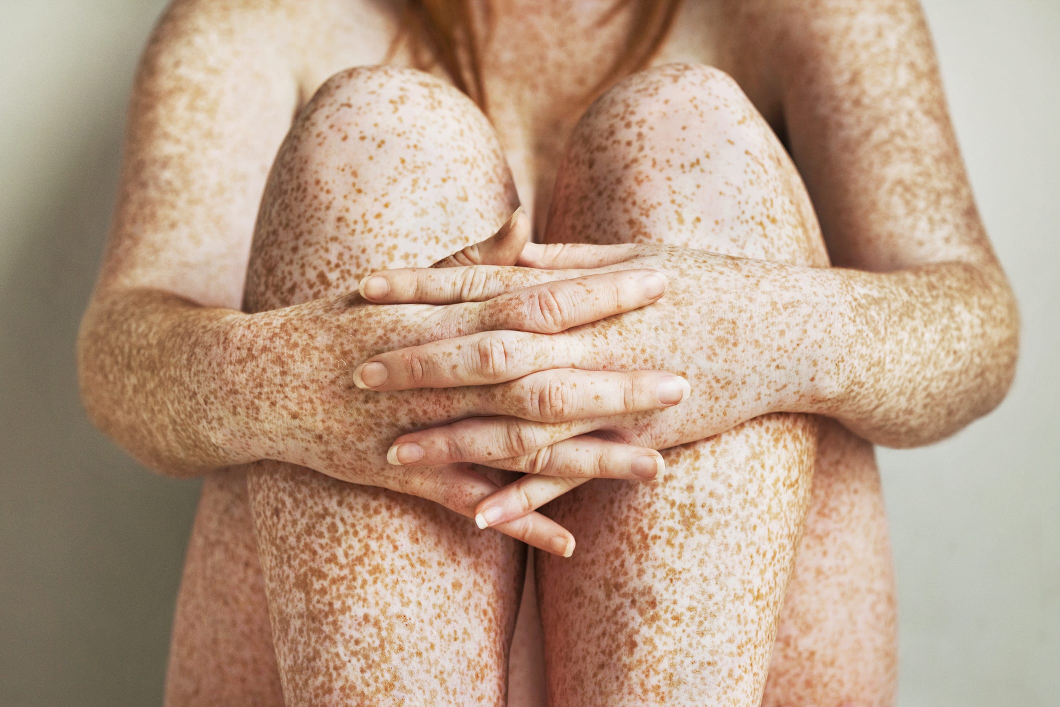Close up of freckled girl's hands folded in front of her legs