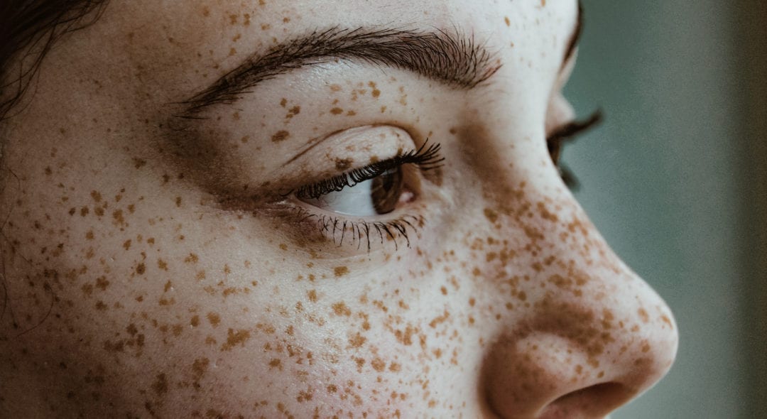 Close-Up Portrait Of Young Woman with freckles on face