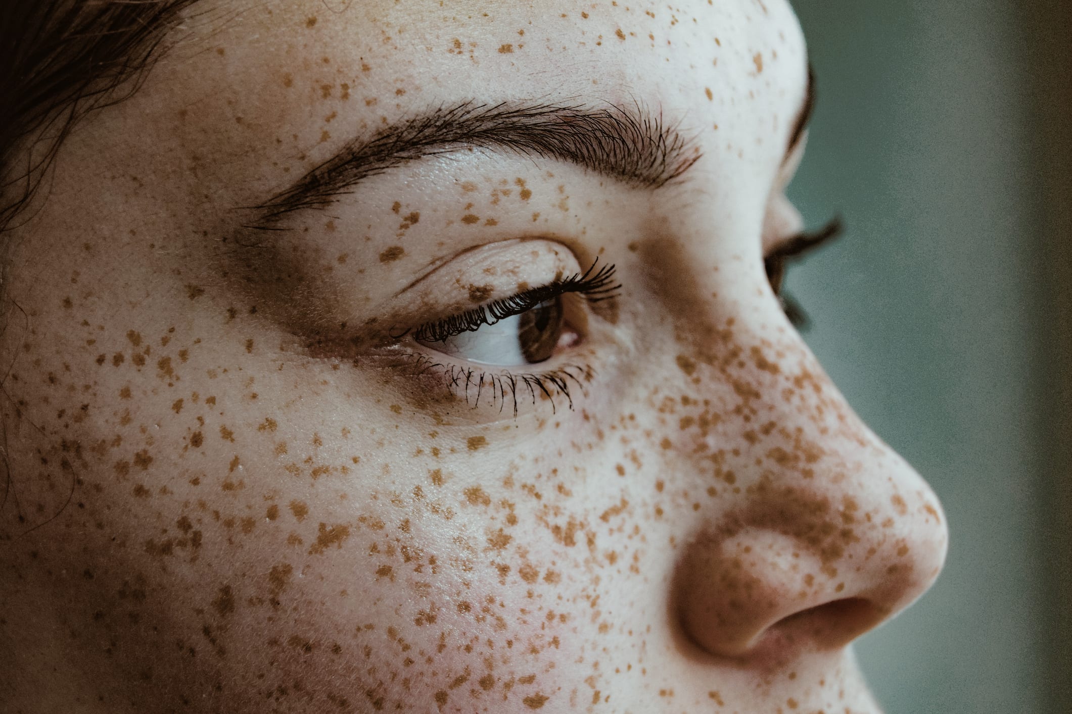 Close-Up Portrait Of Young Woman with freckles on face