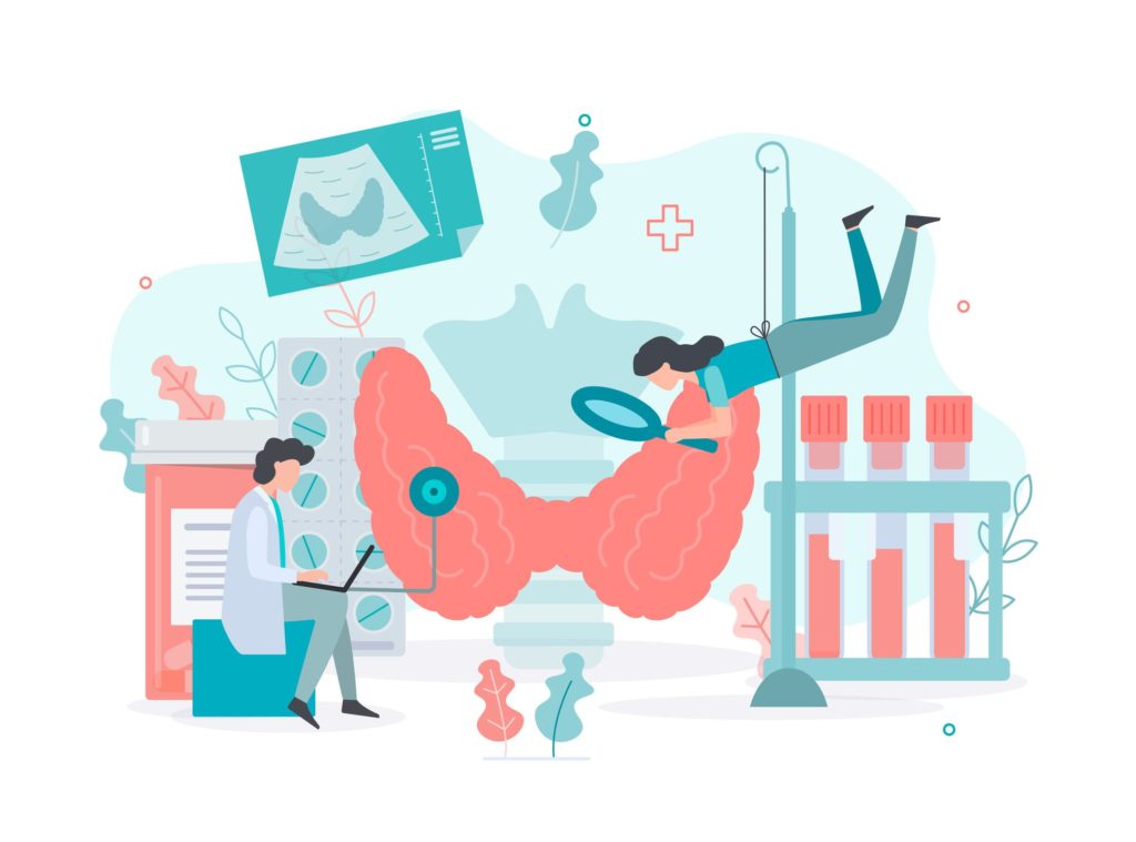 Diagnostics and treatment of thyroid diseases. Thyroid health concept Medical concept with tiny people. Flat vector illustration.