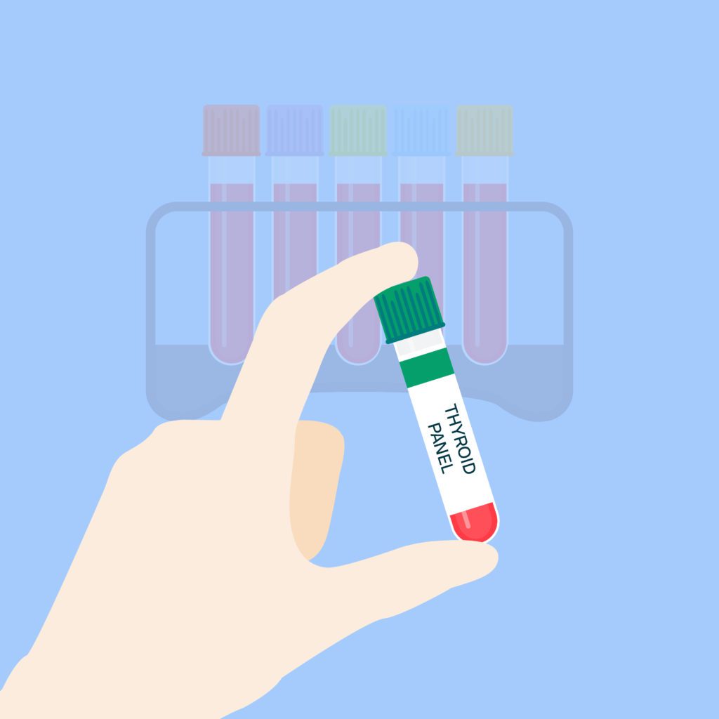Medical tubing for thyroid panel test. Hand holding blood sample. Laboratory centrifuge tubing with green top. Medical equipment on blue background. Vector illustration.