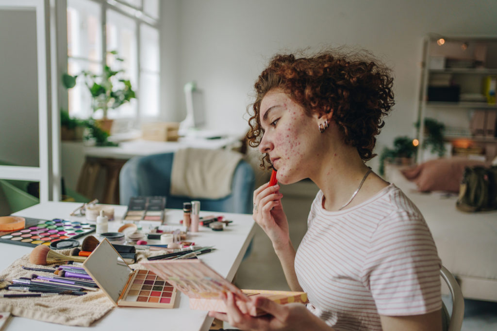 woman with acne applying makeup on desk