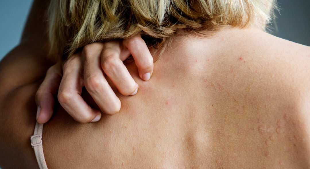 woman scratching back