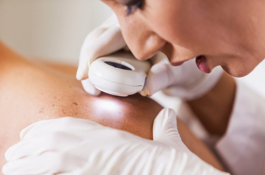 dermatologist inspecting skin