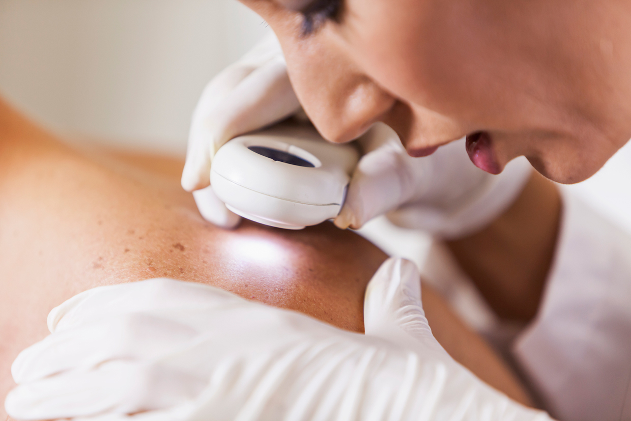 dermatologist inspecting skin