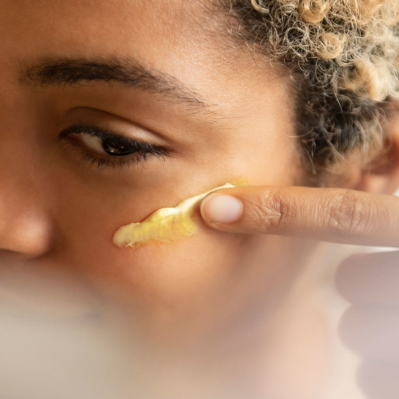 Can Vitamin C Cause Acne? Sunday Edit