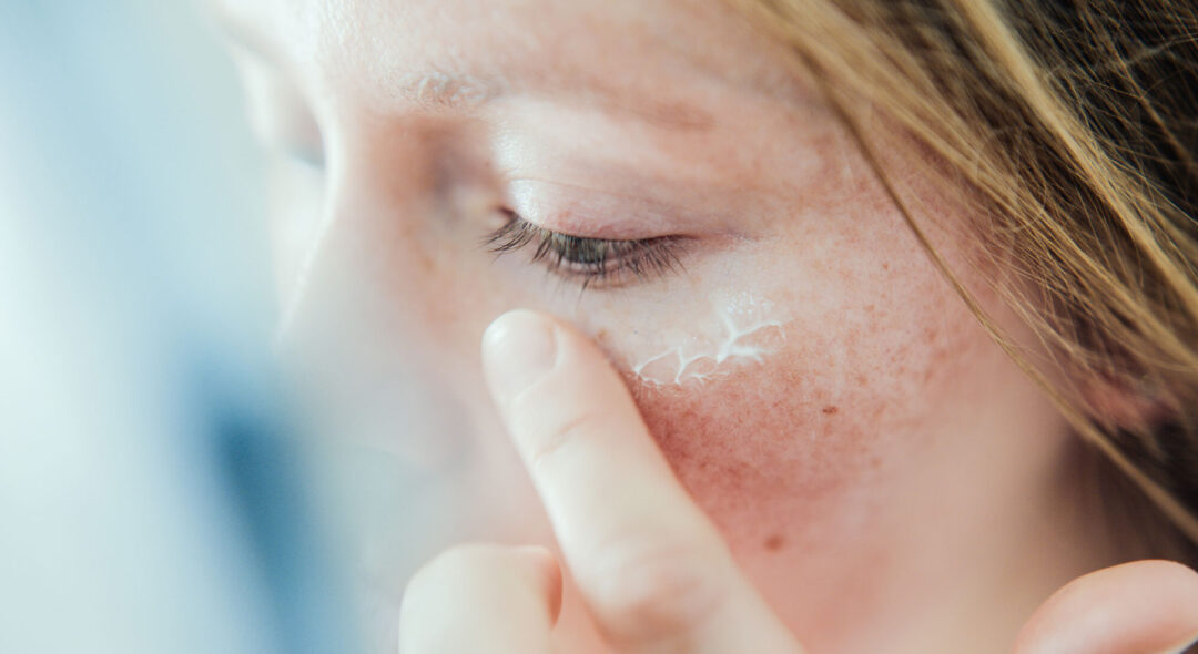 Woman applying skin face cream