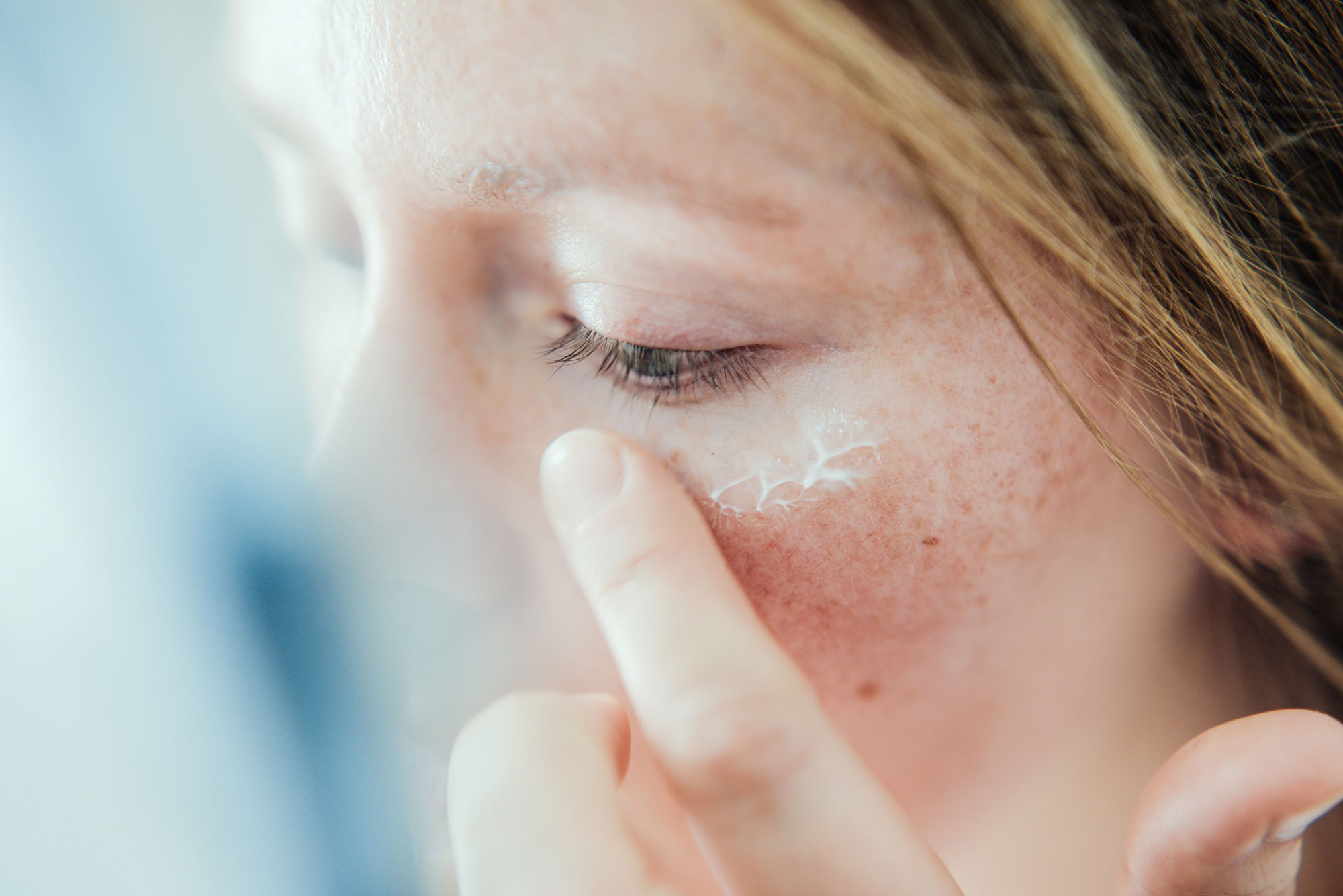 Woman applying skin face cream