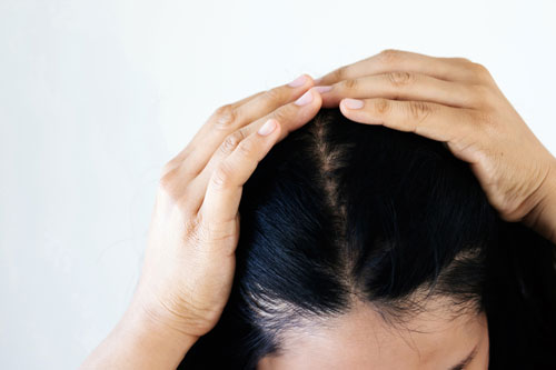 close up of woman's scalp