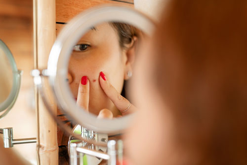 woman squeezes a pimple on face in front of mirror